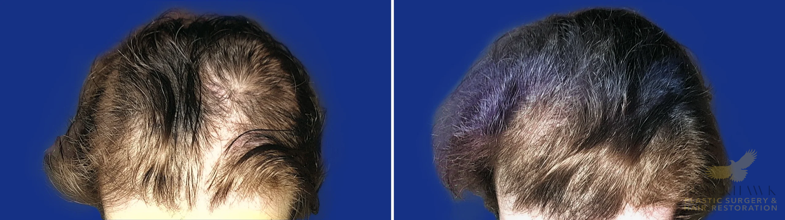 View • Before | After