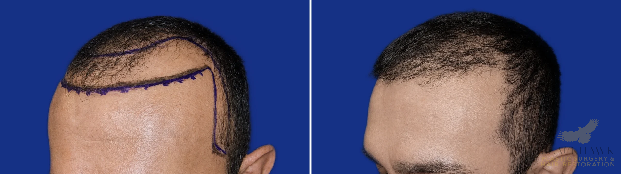 View • Before | After
