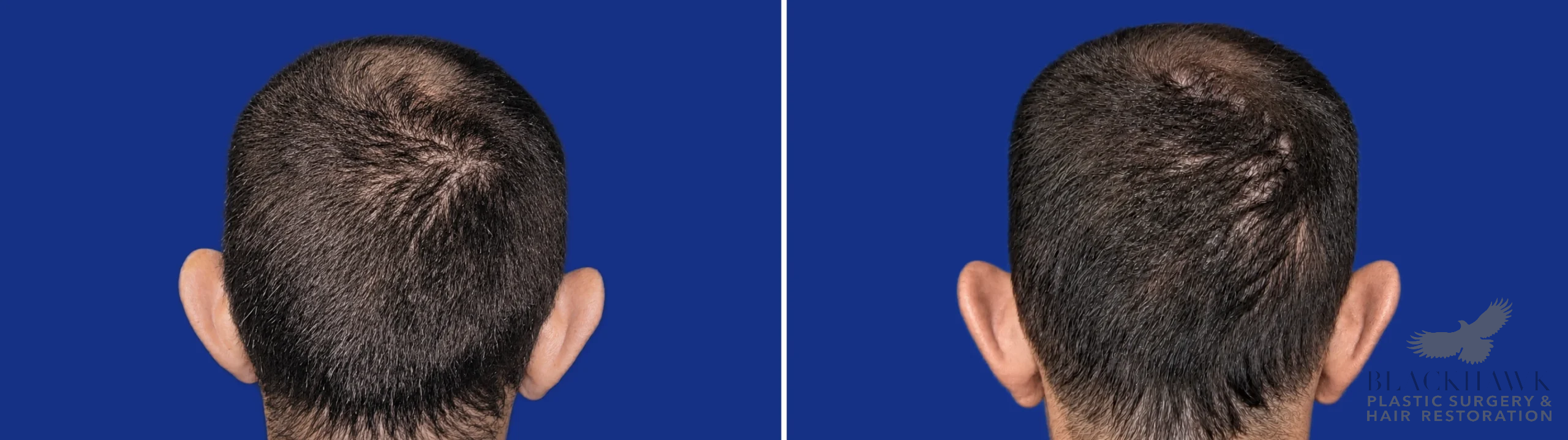 View • Before | After