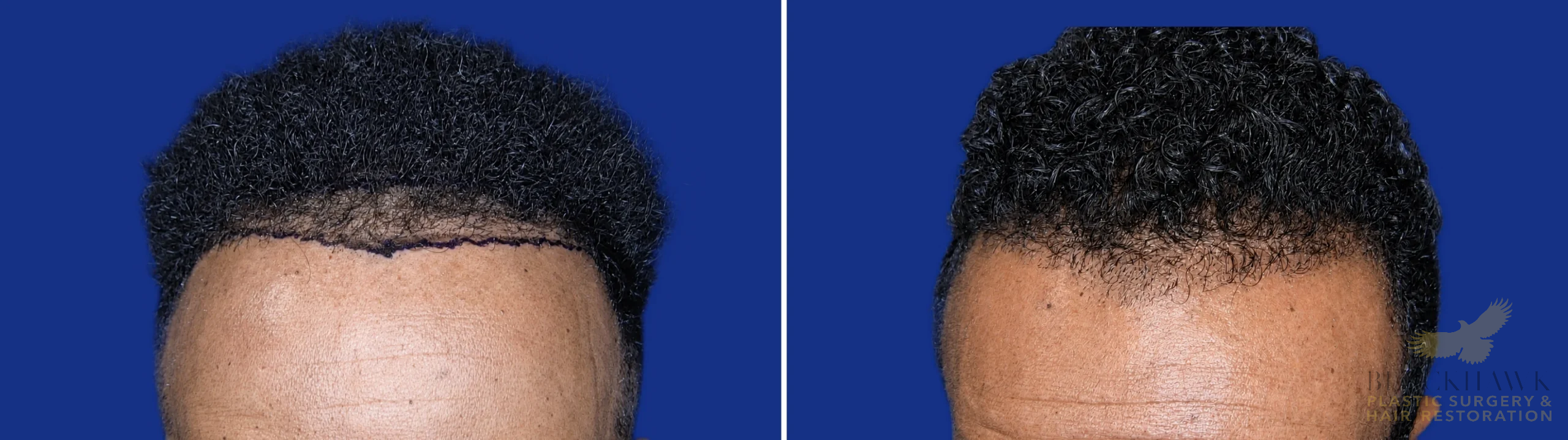View • Before | After