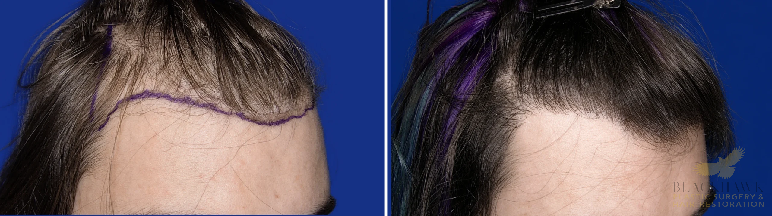 View • Before | After