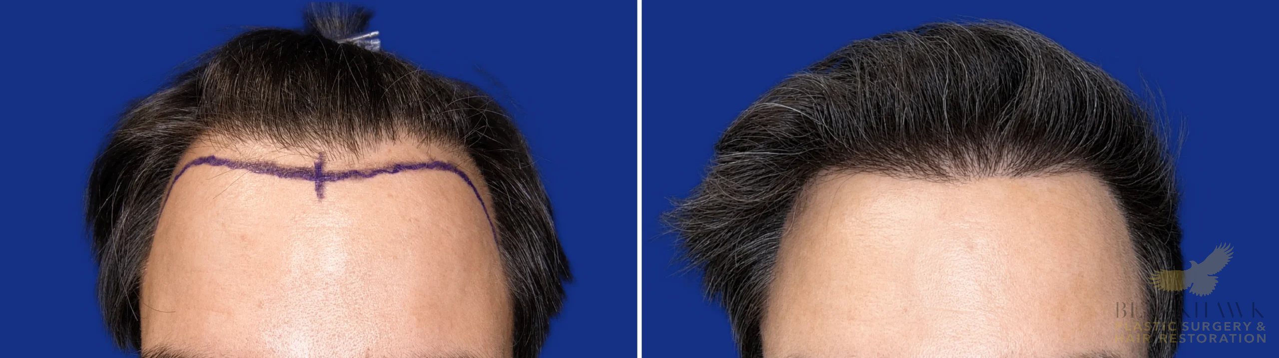 View • Before | After