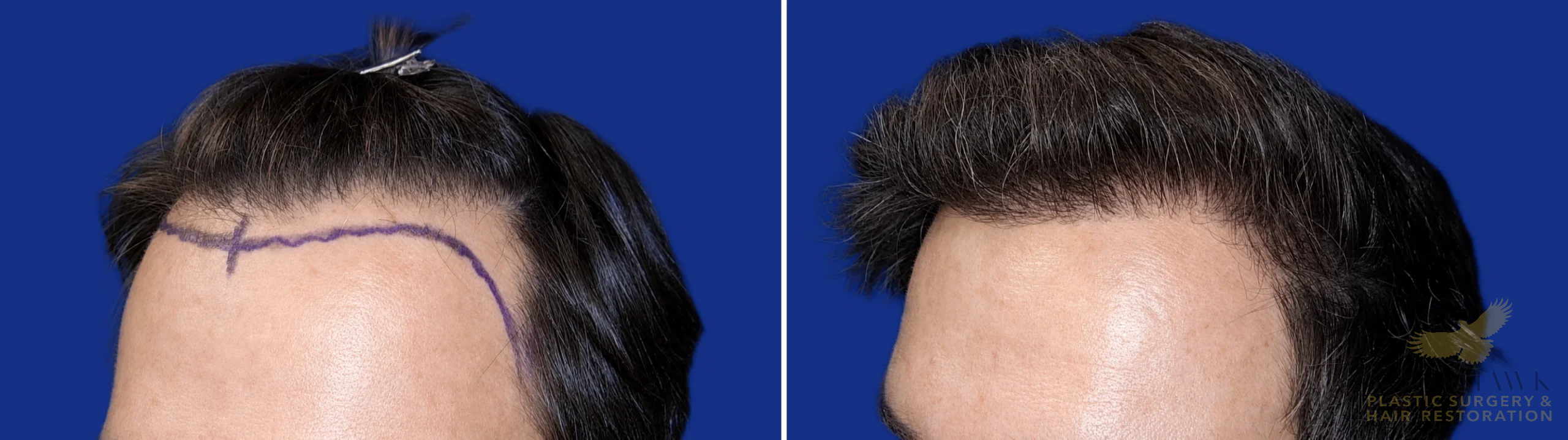 View • Before | After