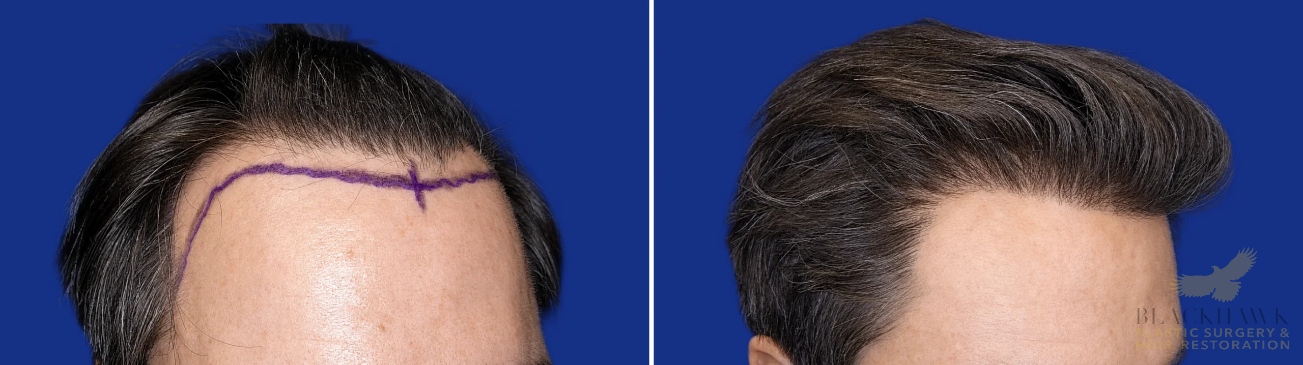 View • Before | After