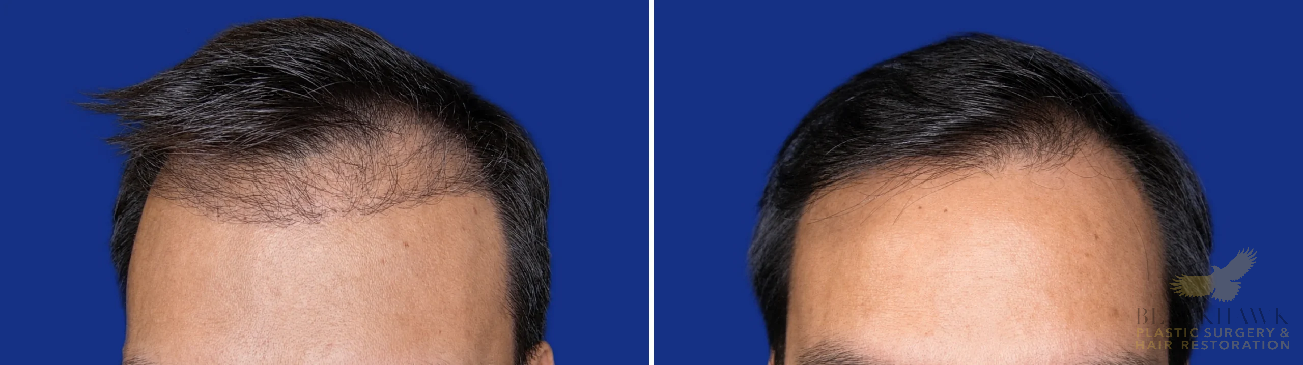 View • Before | After