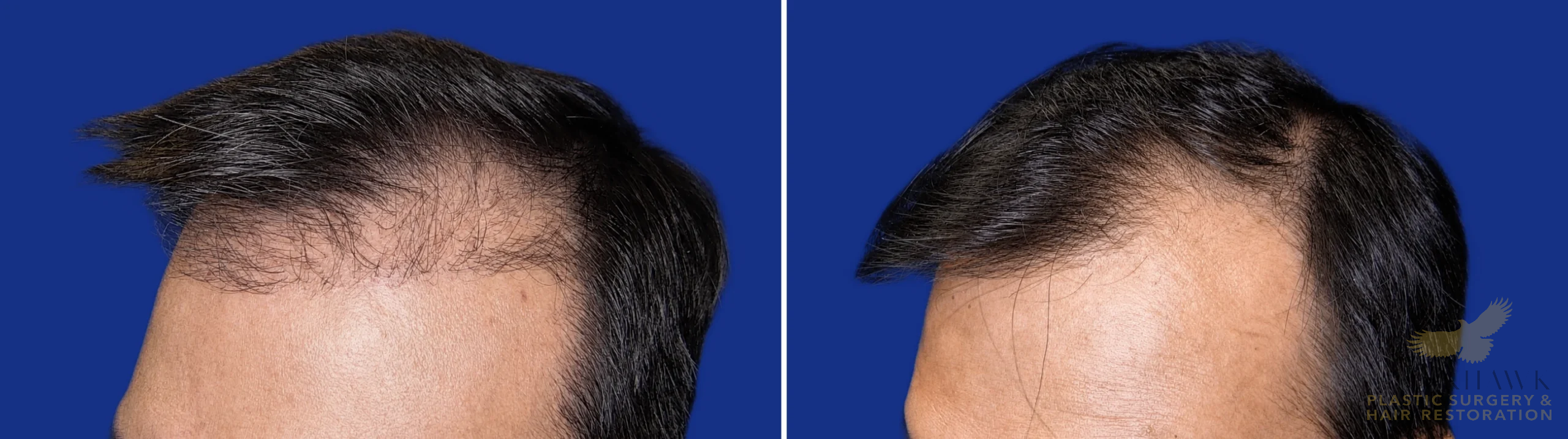 View • Before | After
