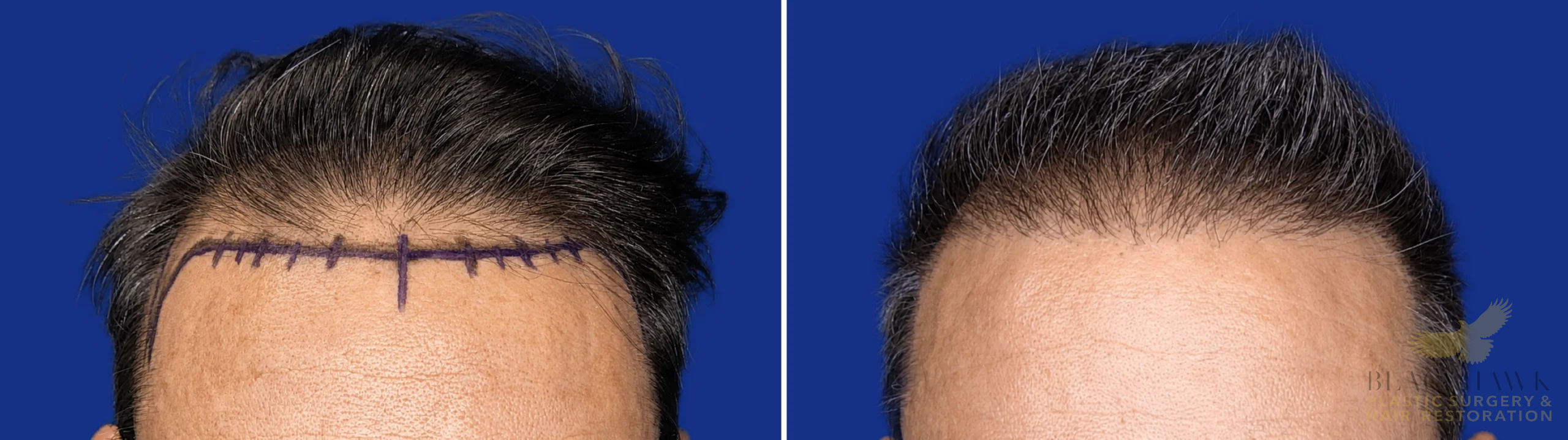 View • Before | After