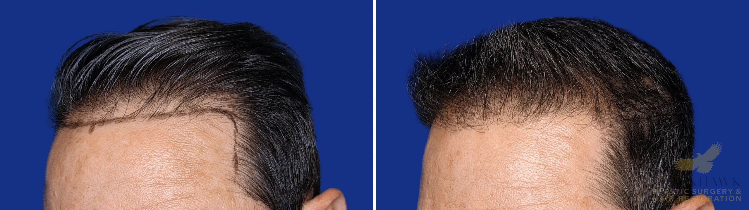 View • Before | After