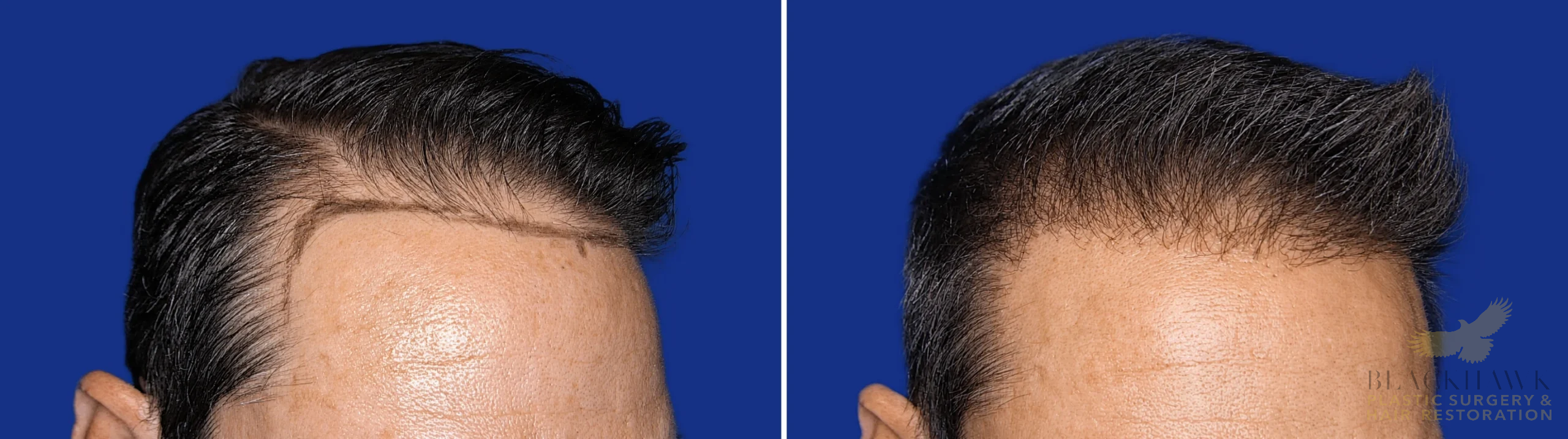 View • Before | After