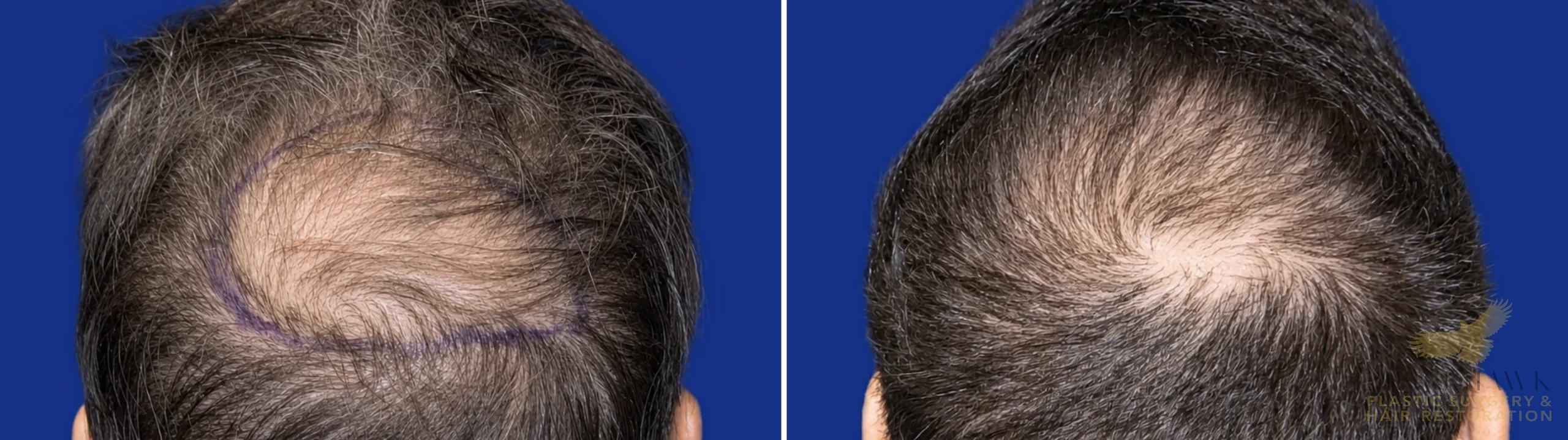 View • Before | After