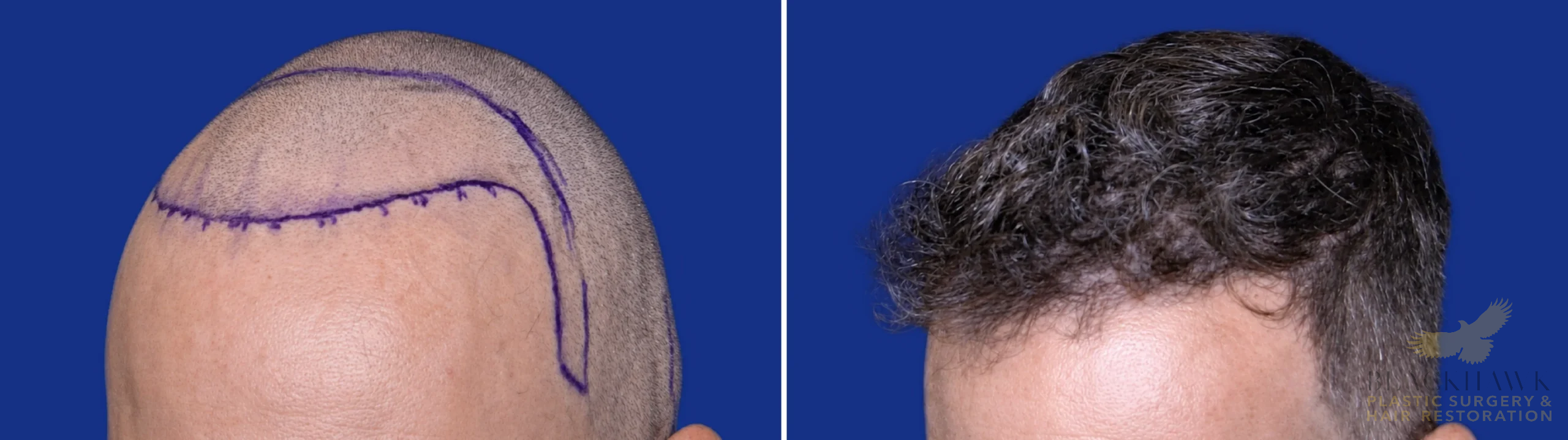 View • Before | After