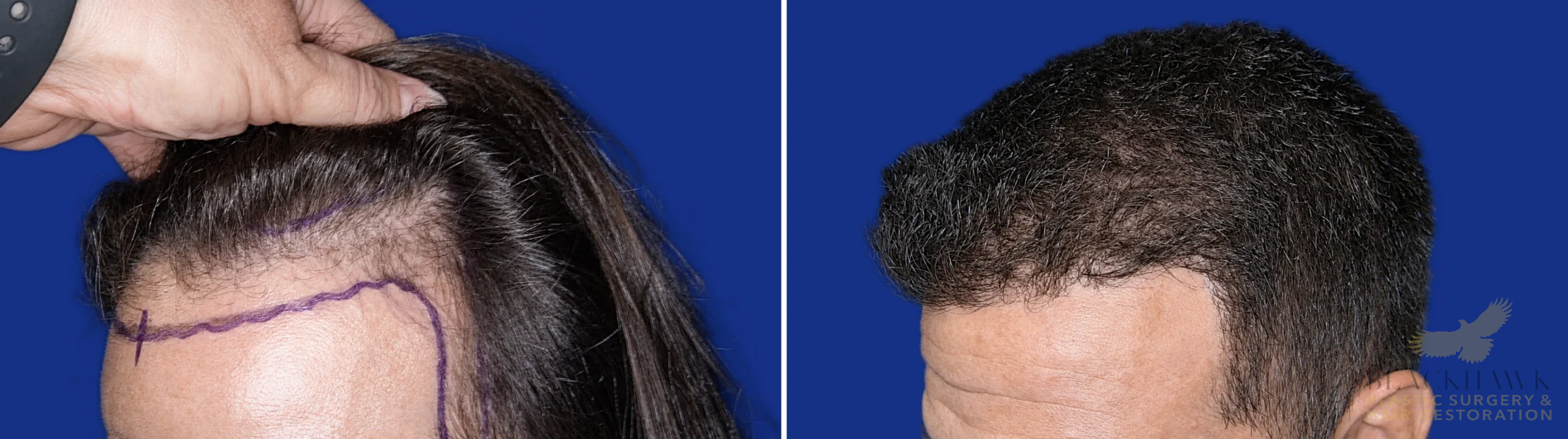View • Before | After
