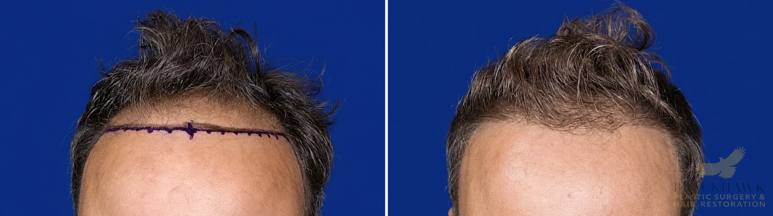 View • Before | After