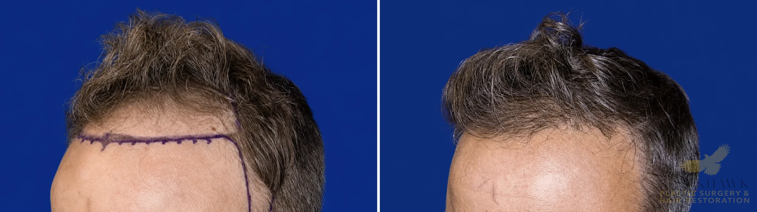 View • Before | After