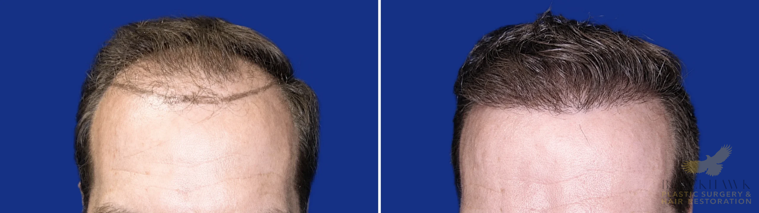 View • Before | After