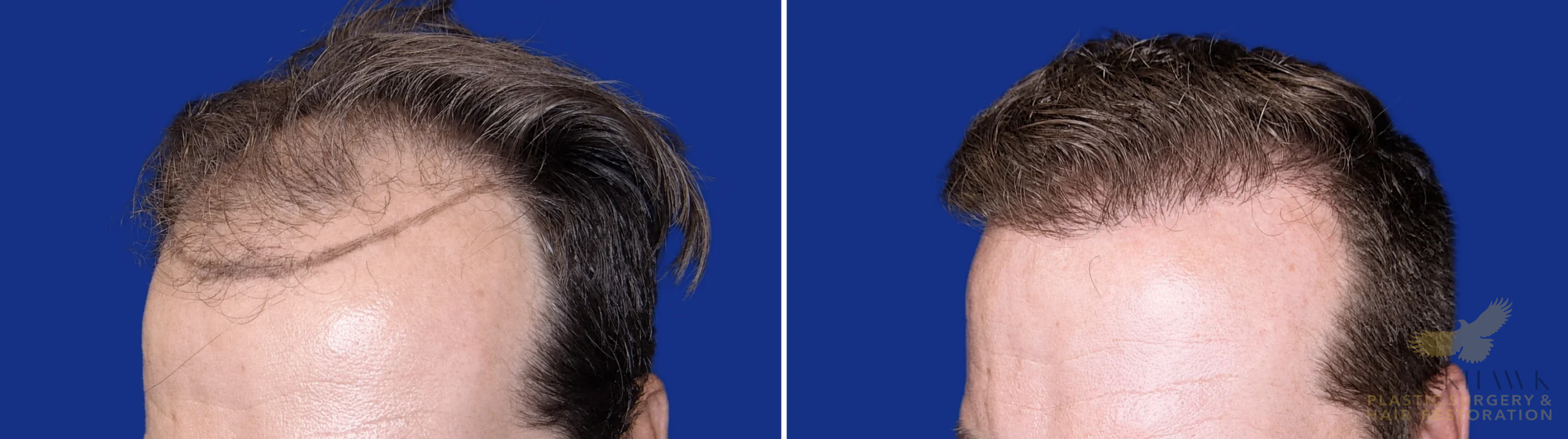 View • Before | After