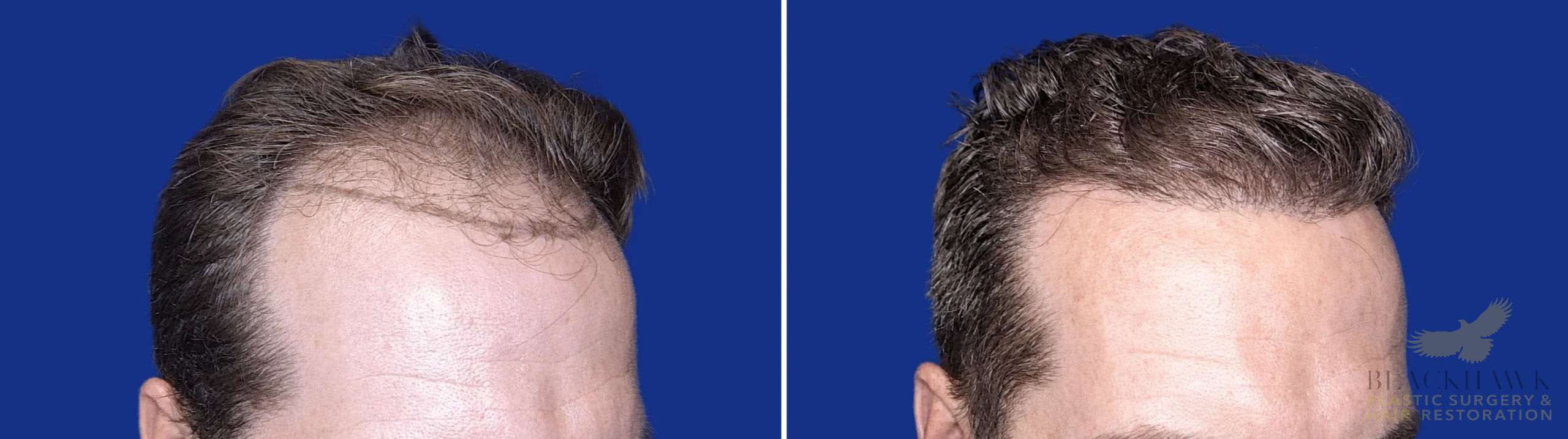 View • Before | After
