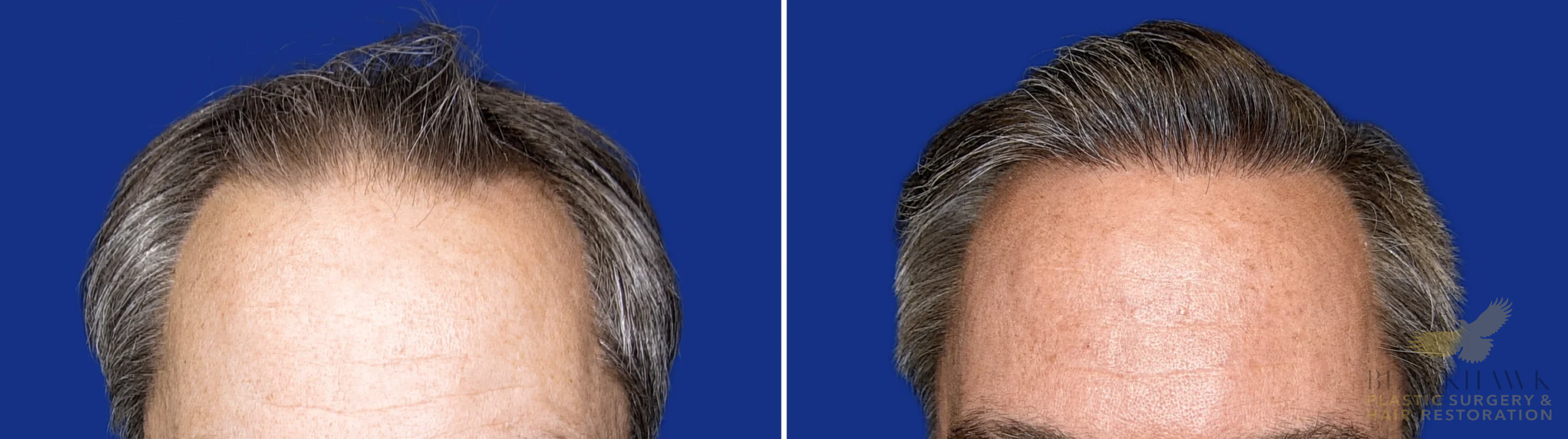 View • Before | After