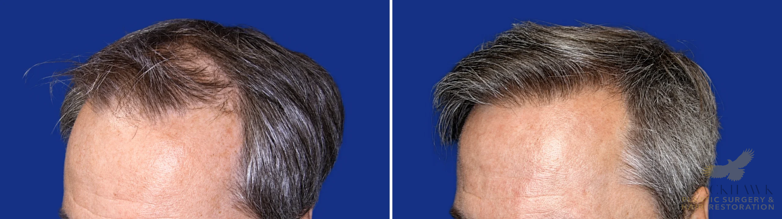 View • Before | After
