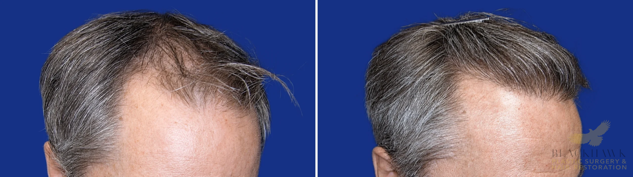 View • Before | After