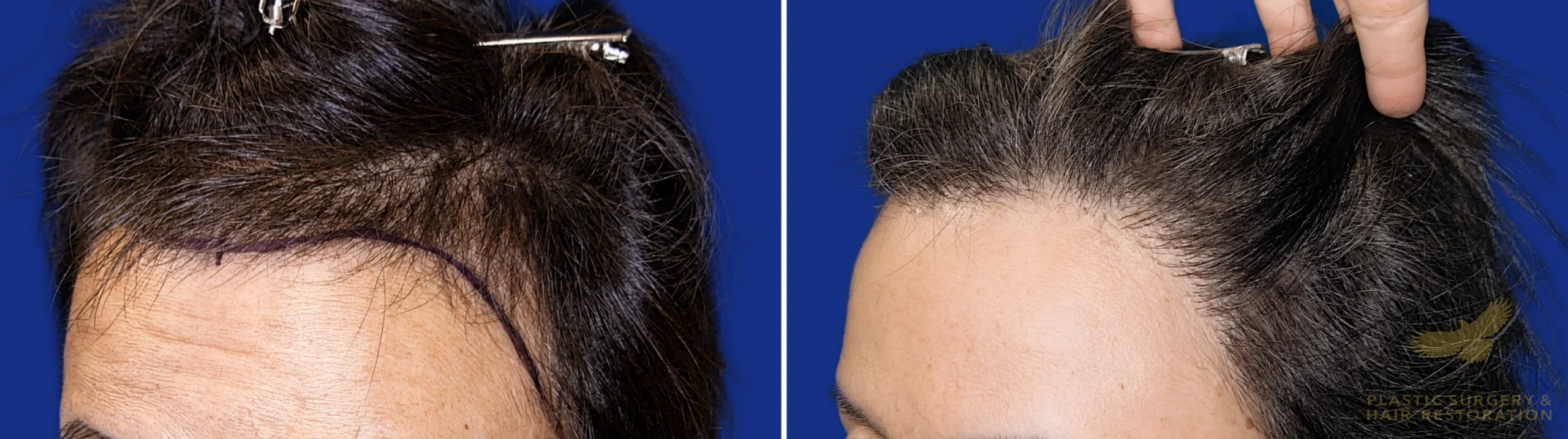 View • Before | After