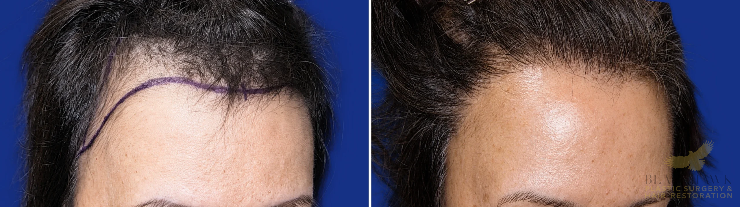 View • Before | After