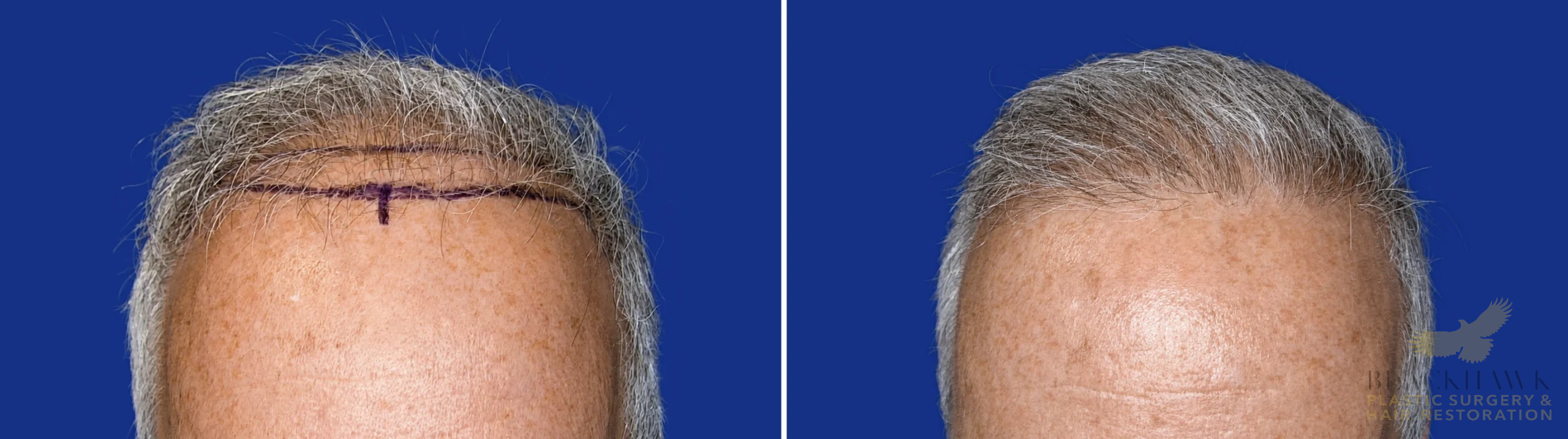 View • Before | After