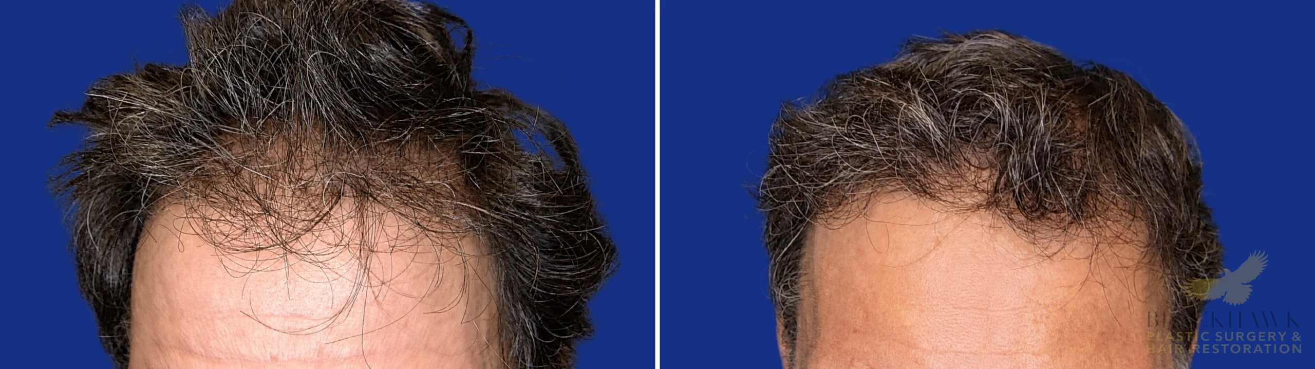 View • Before | After