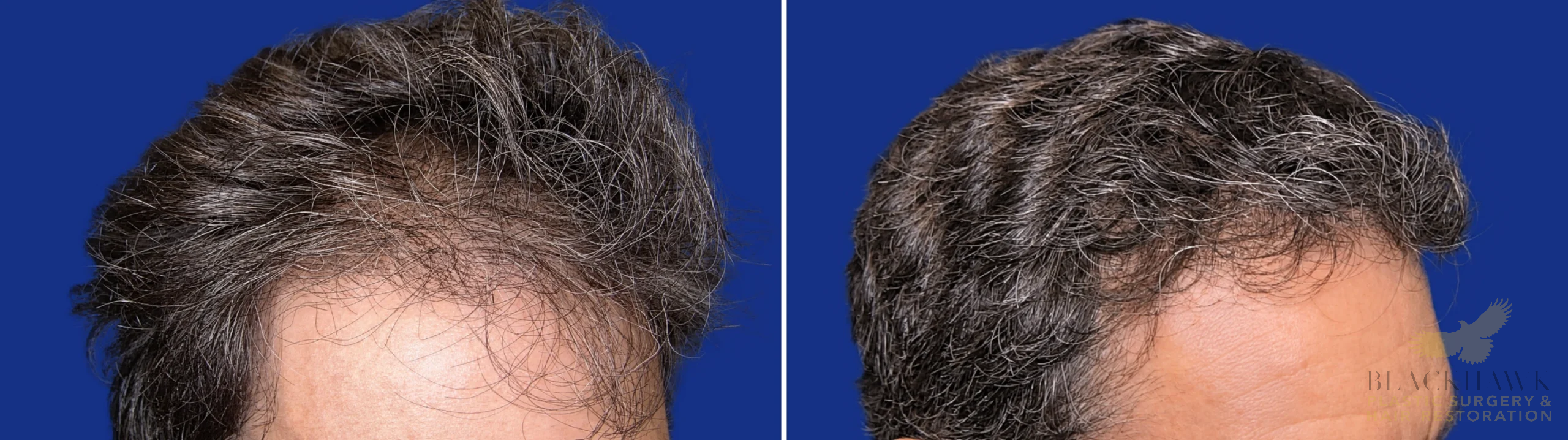 View • Before | After