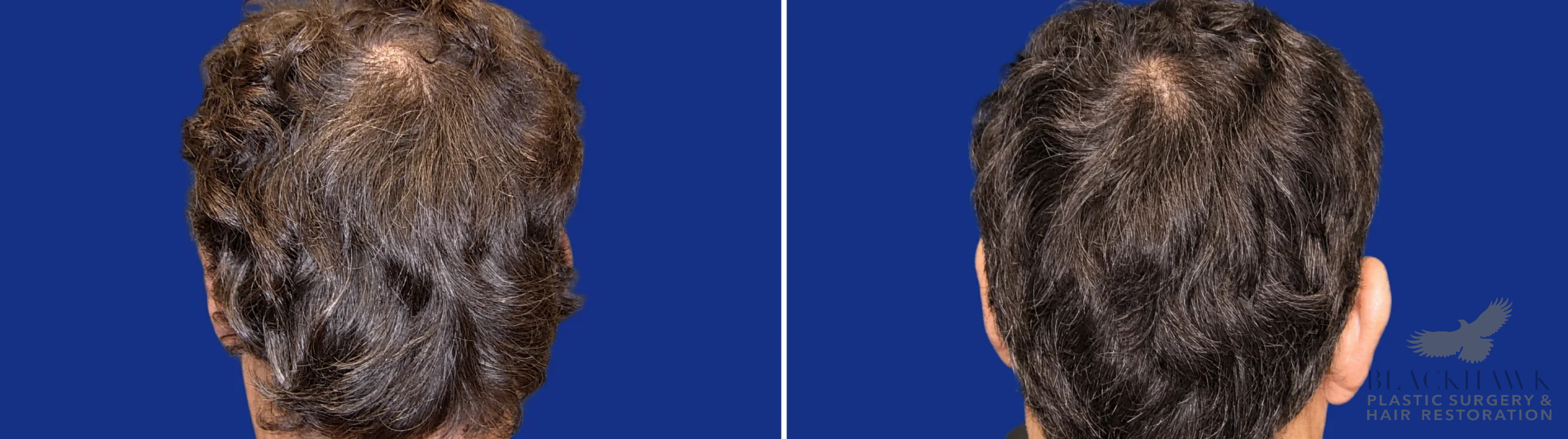 View • Before | After