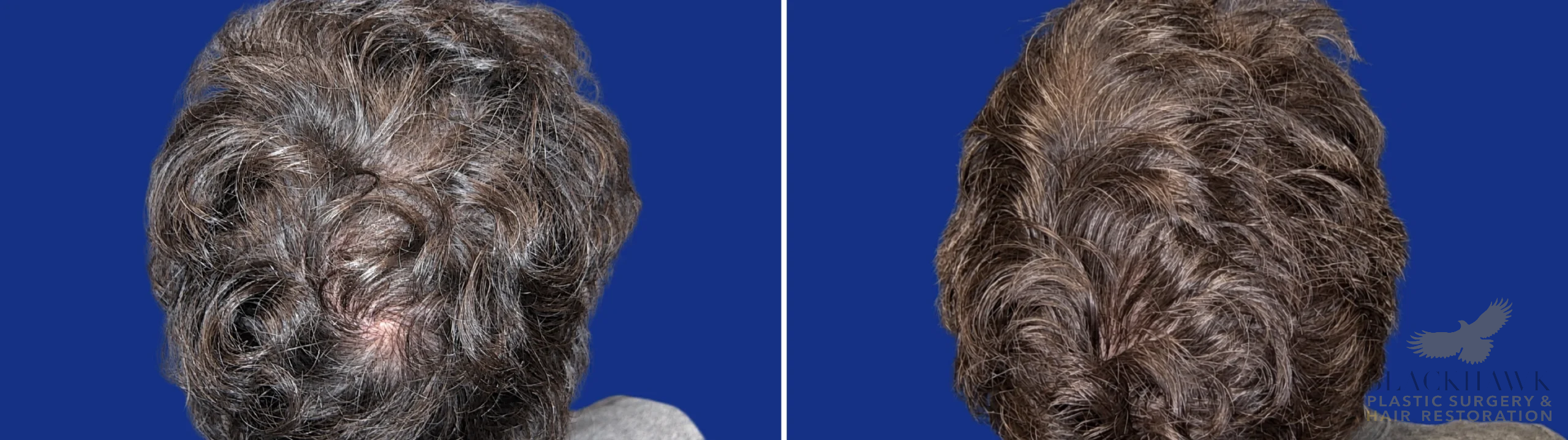 View • Before | After