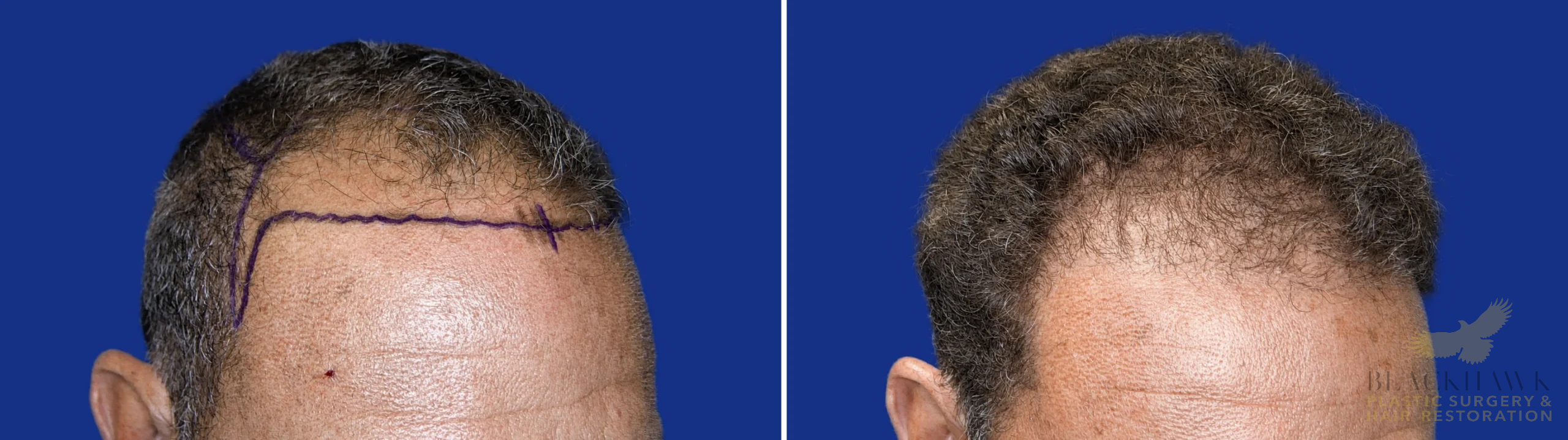 View • Before | After