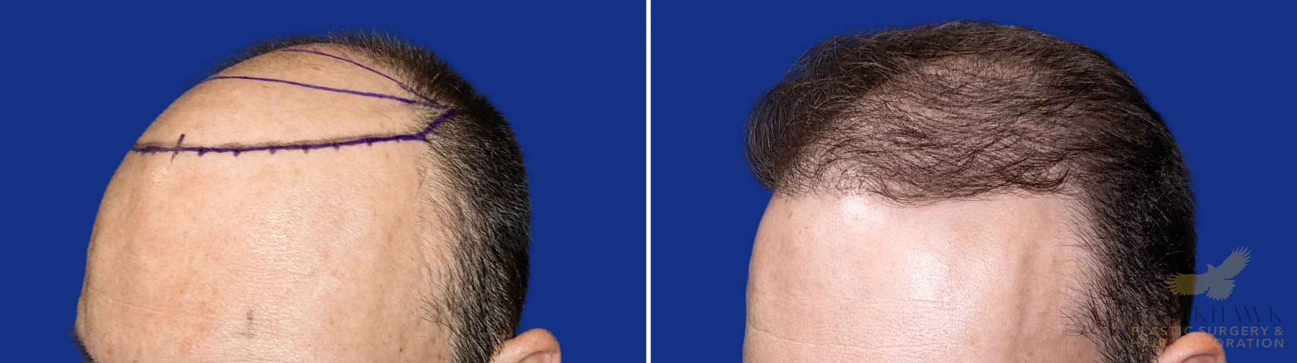 View • Before | After