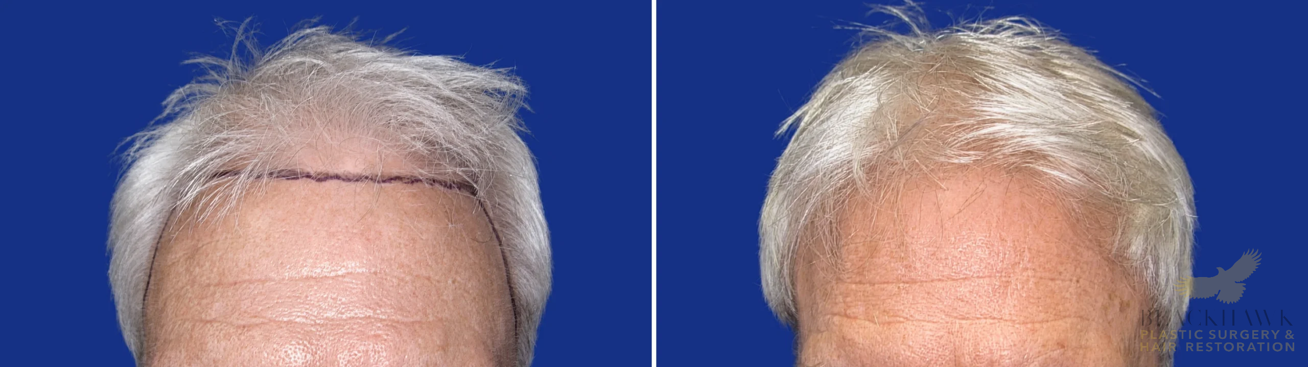 View • Before | After