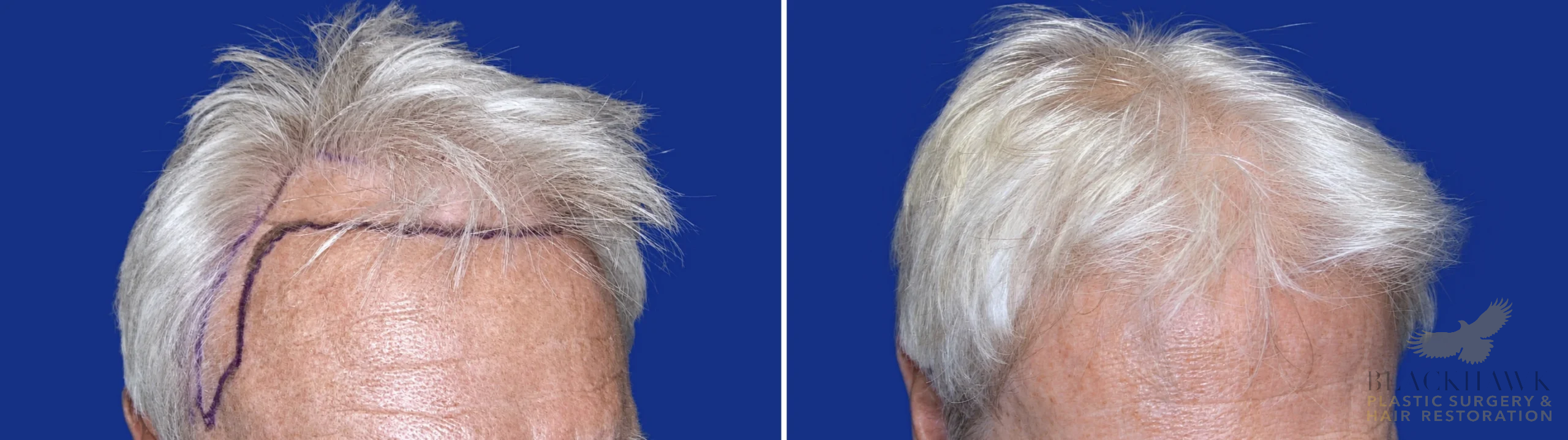 View • Before | After