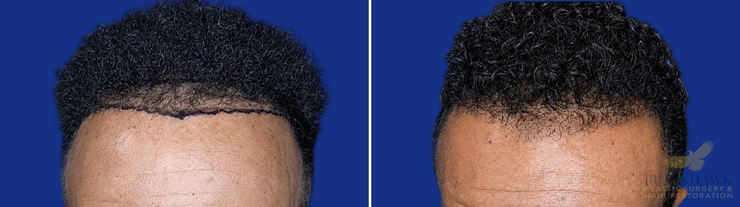 View • Before | After