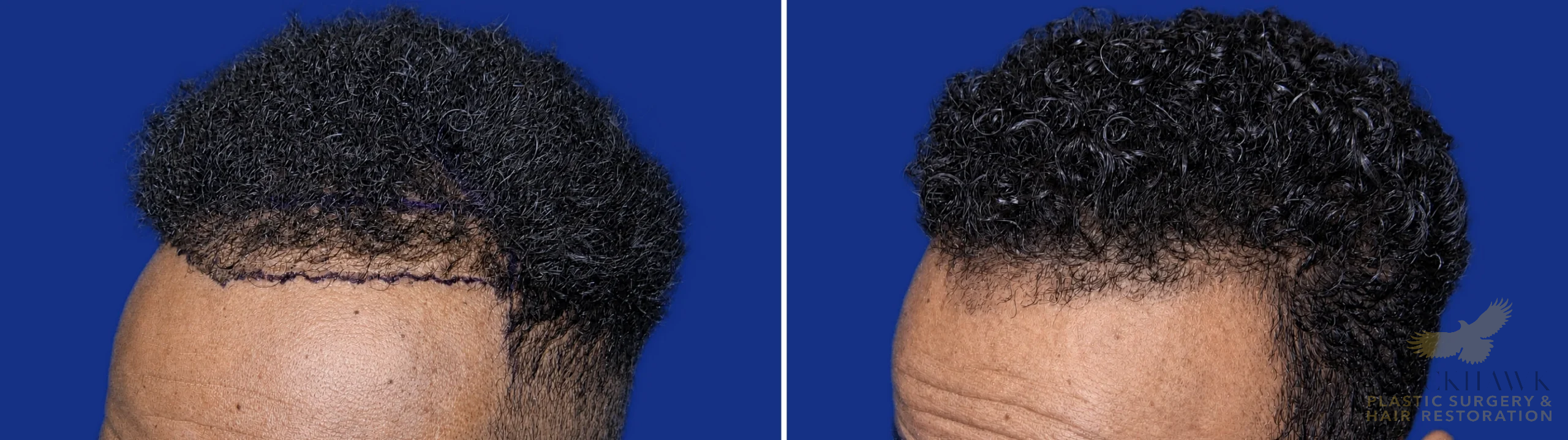 View • Before | After