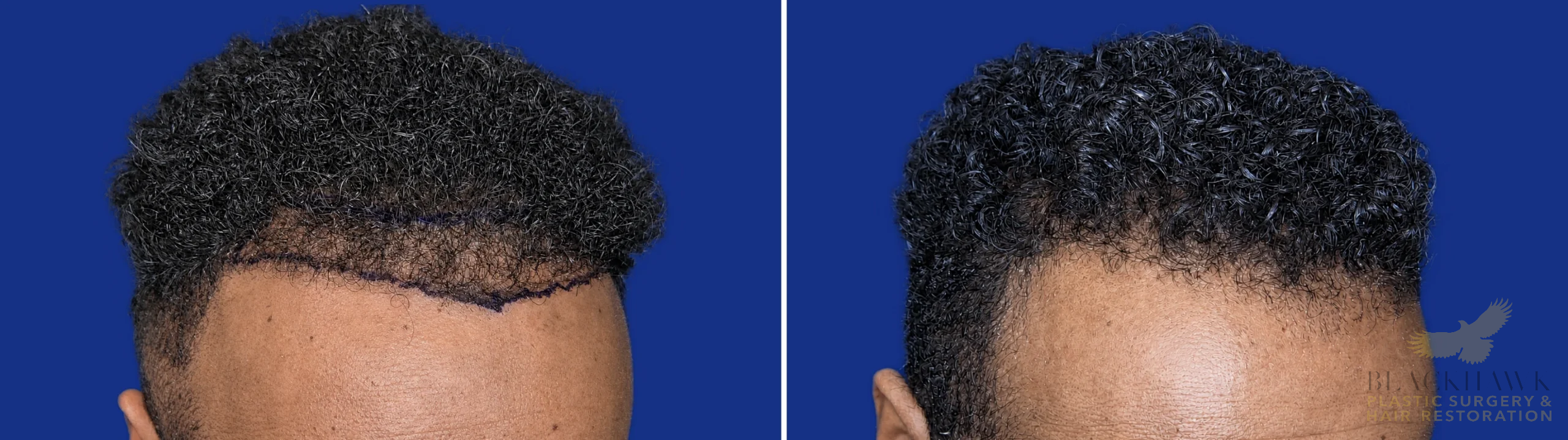 View • Before | After