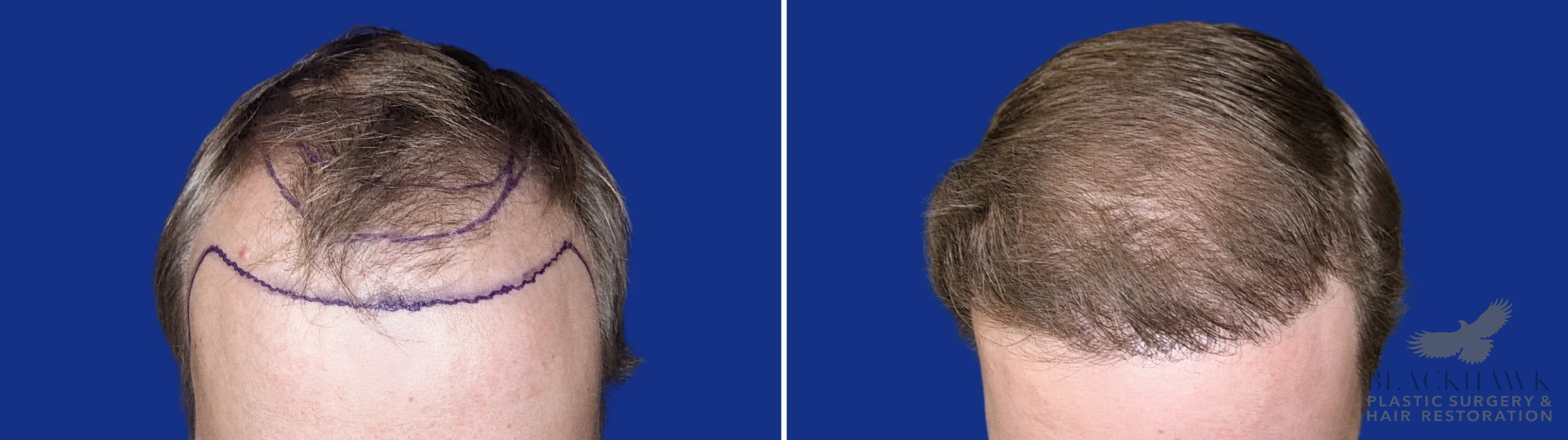 View • Before | After