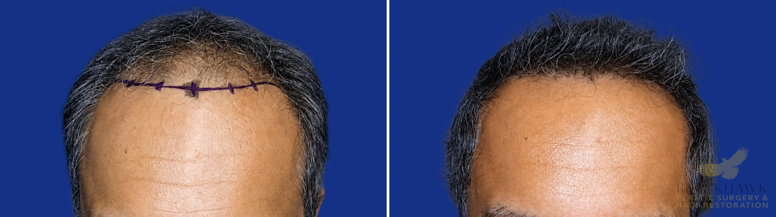 View • Before | After