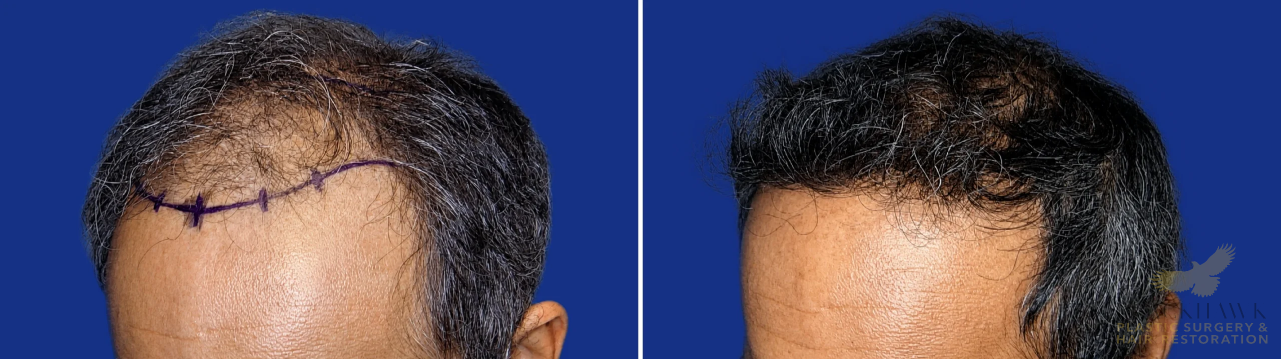 View • Before | After