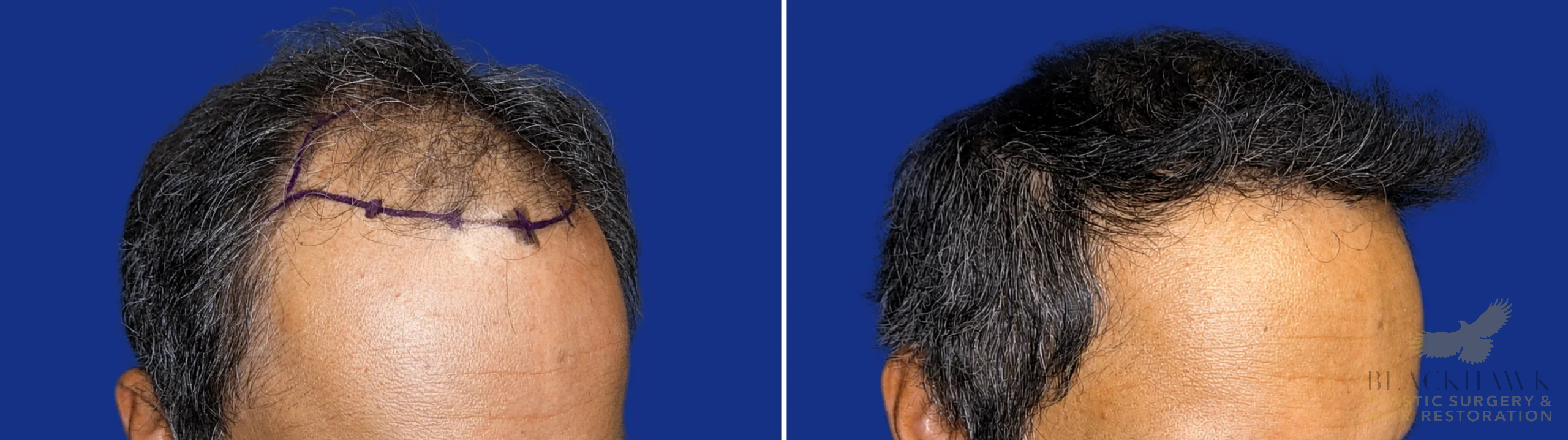 View • Before | After