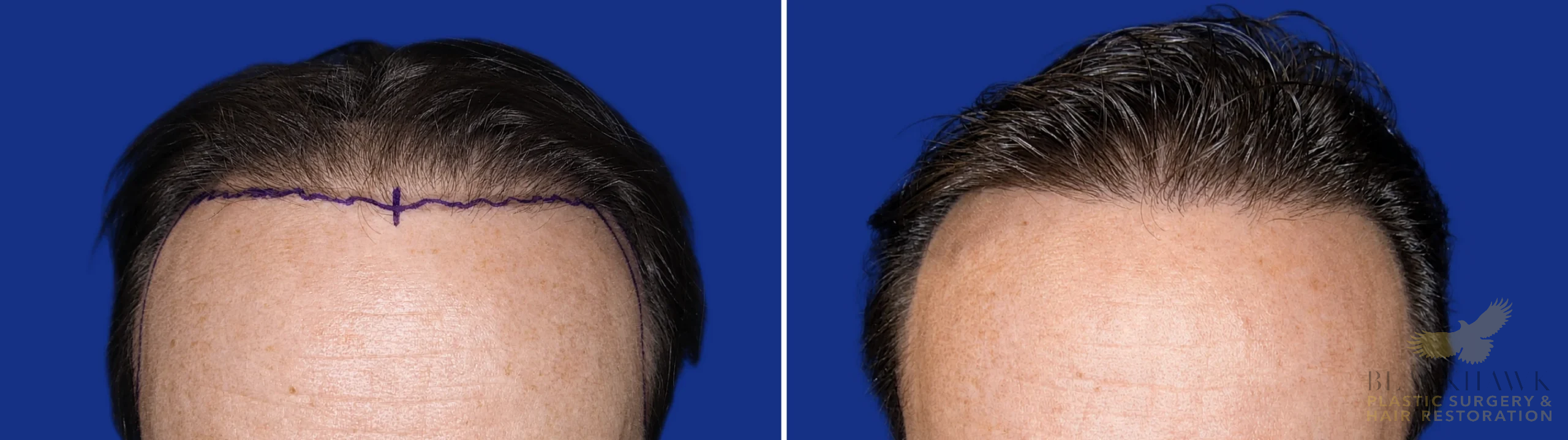 View • Before | After