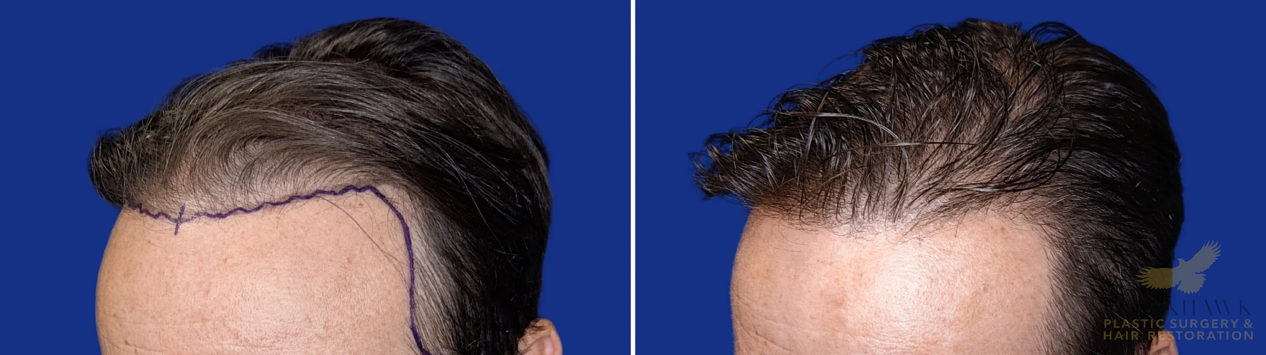 View • Before | After