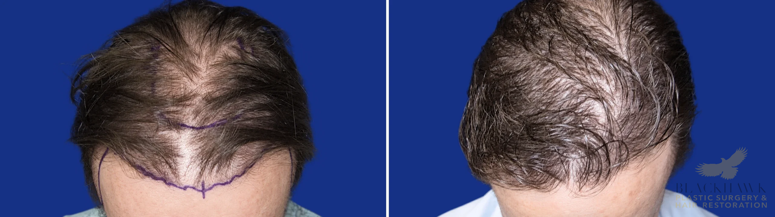 View • Before | After