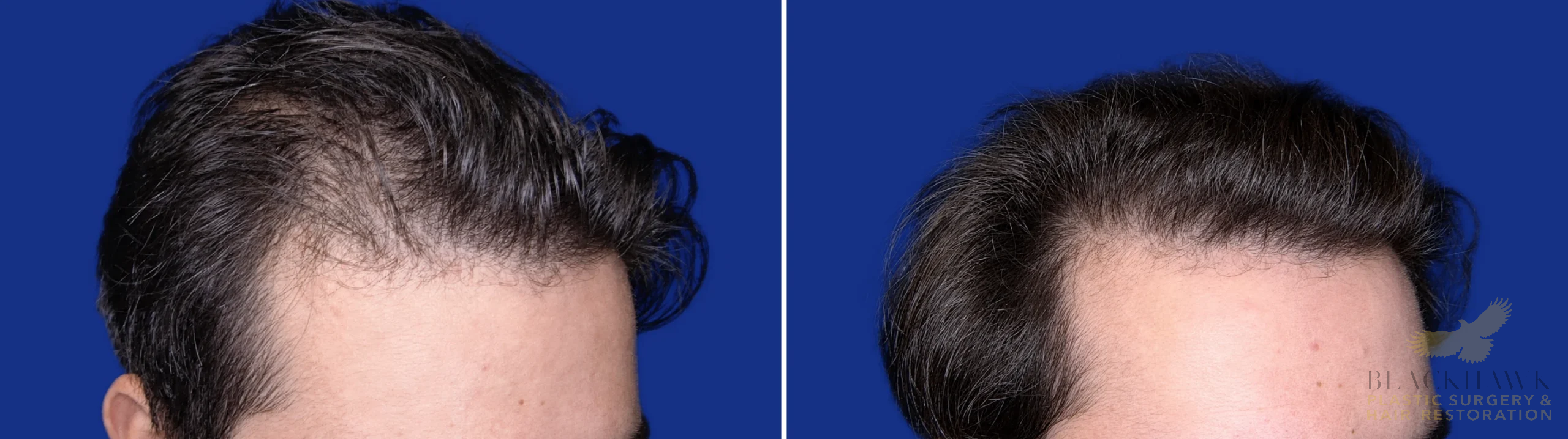 View • Before | After