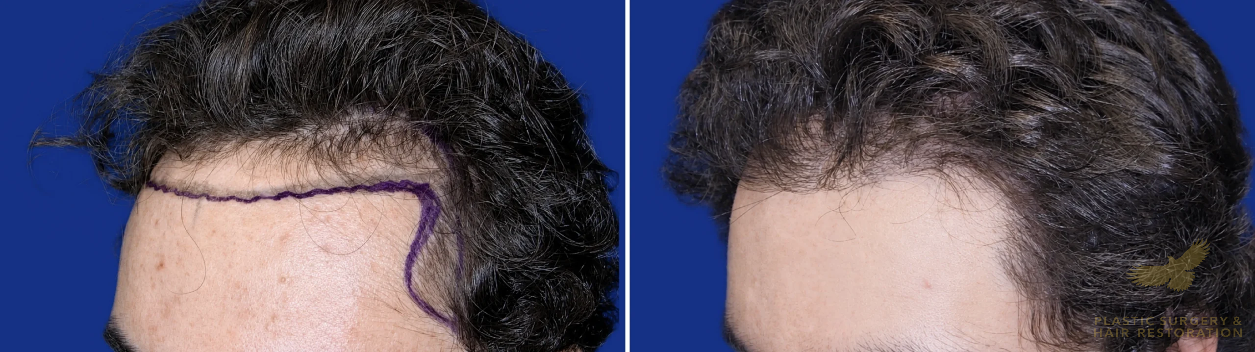 View • Before | After
