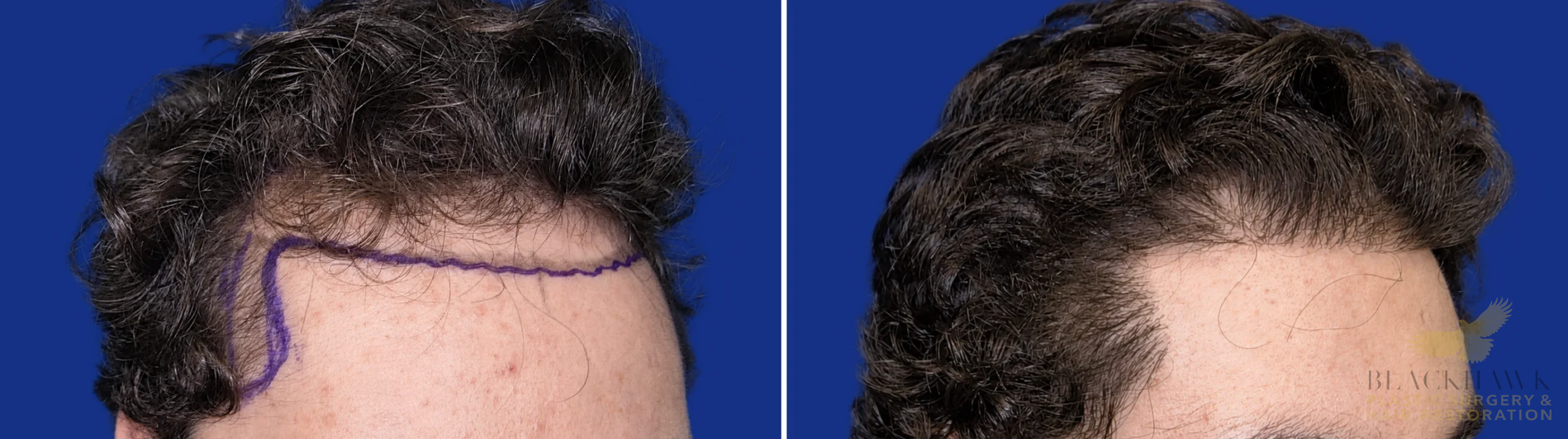 View • Before | After