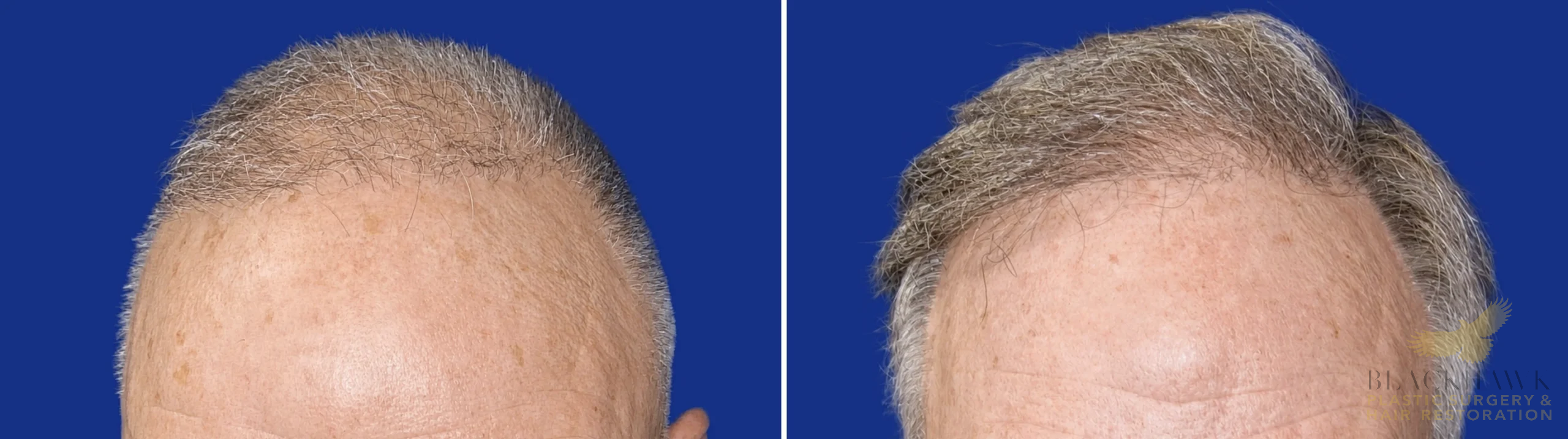 View • Before | After