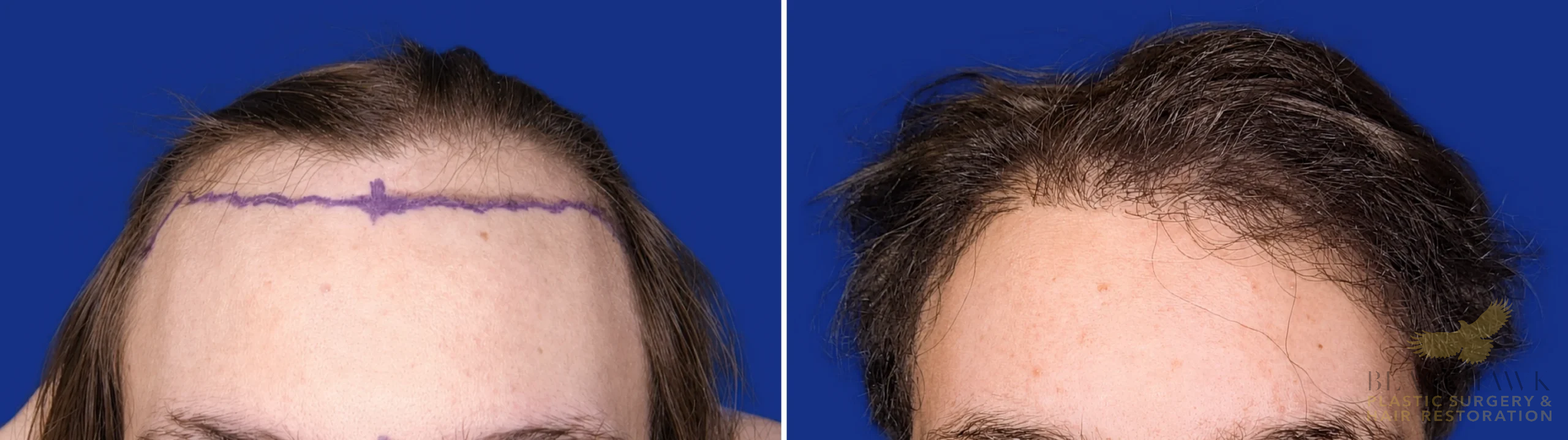 View • Before | After
